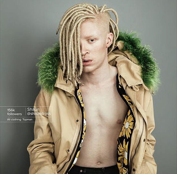 白人肌膚＋黑人五官！Shaun Ross用獨特缺陷美顛覆世界審美觀