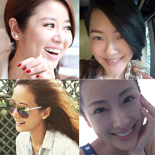 美齒後路人變女神！那些牙齒整齊笑容發光的女星們