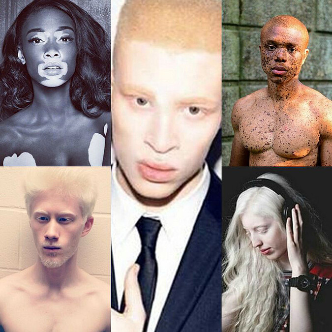 我知道我很美！#InMySkinIWin顛覆世俗美麗標準