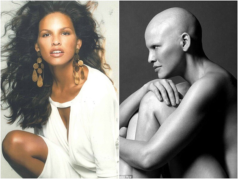 勇敢去愛另一個自己!抗癌女模:「癌症就是這樣,但我卻感覺更加美麗。」