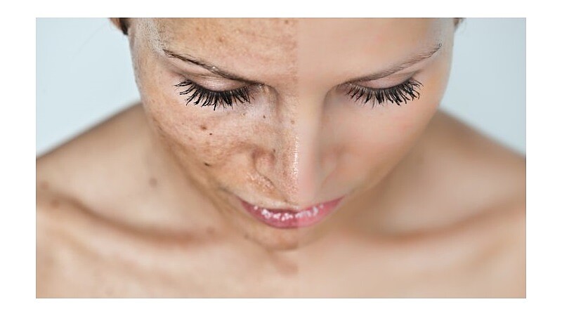 對抗空汙必做保衛戰！還你一個乾淨肌膚