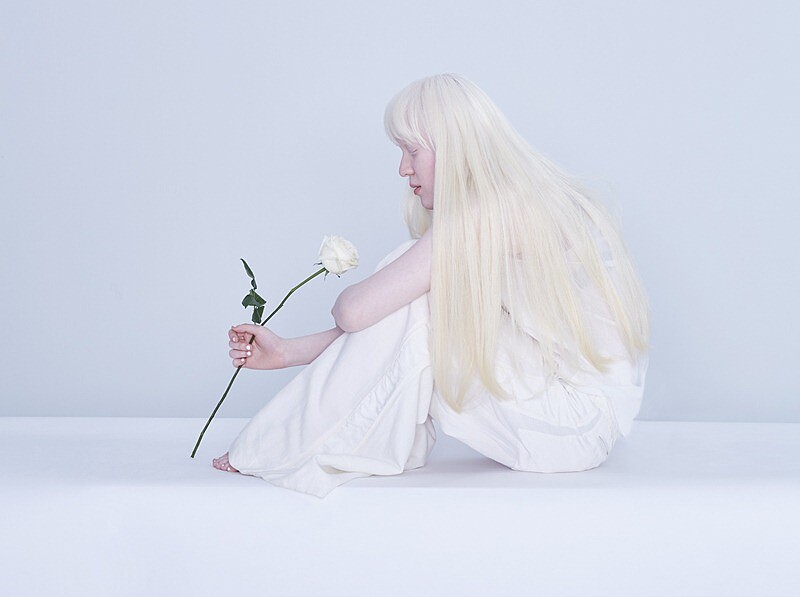 【Stay Different】月亮的孩子 白化症女孩 楊依菱