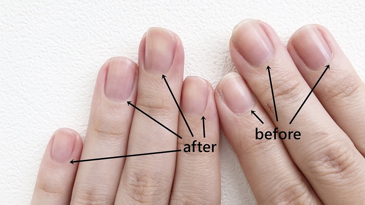 【保養知識王】日常「剪指甲」最常遇到的5個問題一次解答！什麼時候剪最好？長度要剪到多長？指緣硬皮怎麼處理？