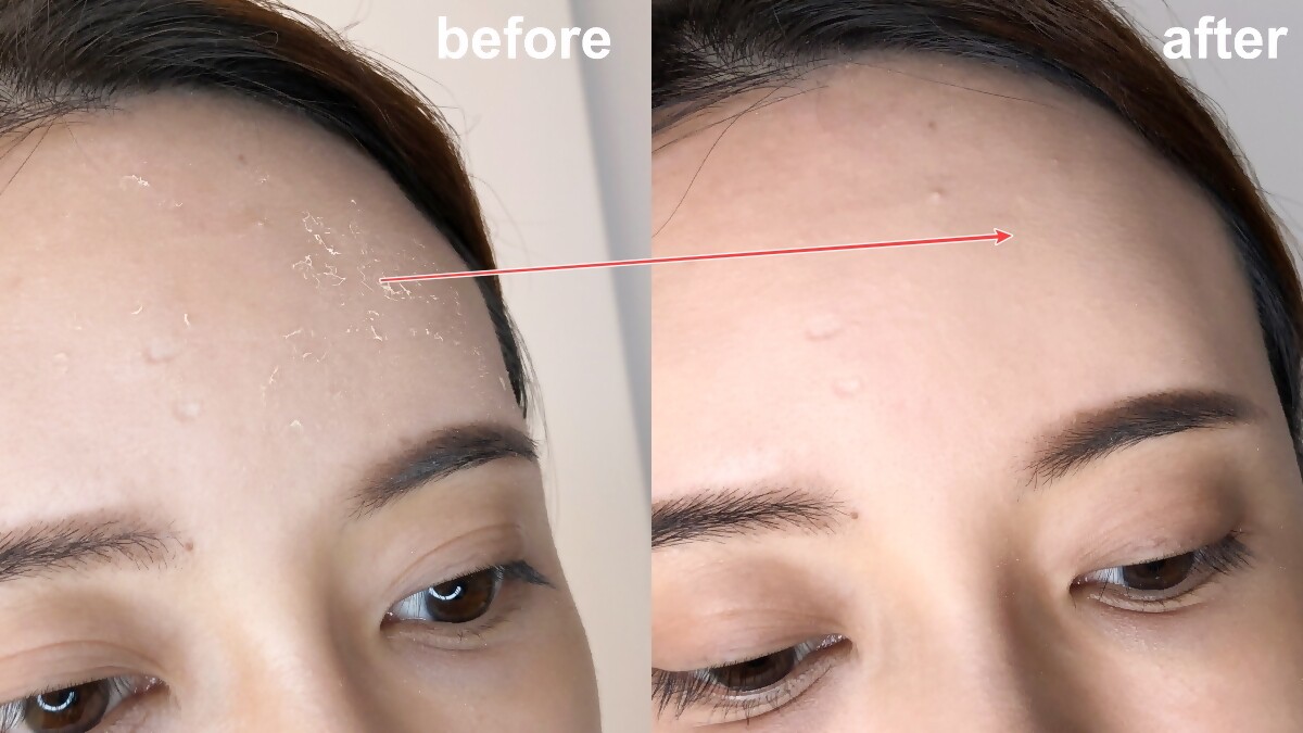 上妝後脫皮超明顯？千萬不能硬撕！原來「厚敷保濕凝凍+紗布巾畫圓」就可以迅速解救乾燥脫皮