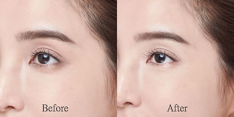 有效改善黑眼圈、眼周暗沈細紋和細疏睫毛