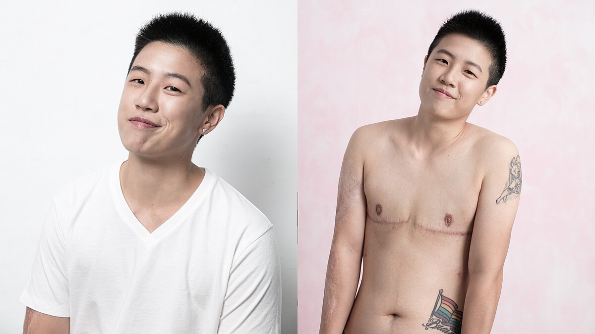 疤痕讓我獨一無二！周旻琦，「活到30歲，終於開始喜歡我的身體。」