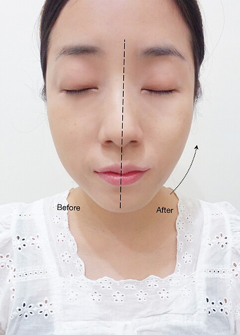 Ｍ編實際以小花托腮按摩法測試一邊臉後，臉部線條明顯往上提升，緊實拉提的傳說是真的啊！！！