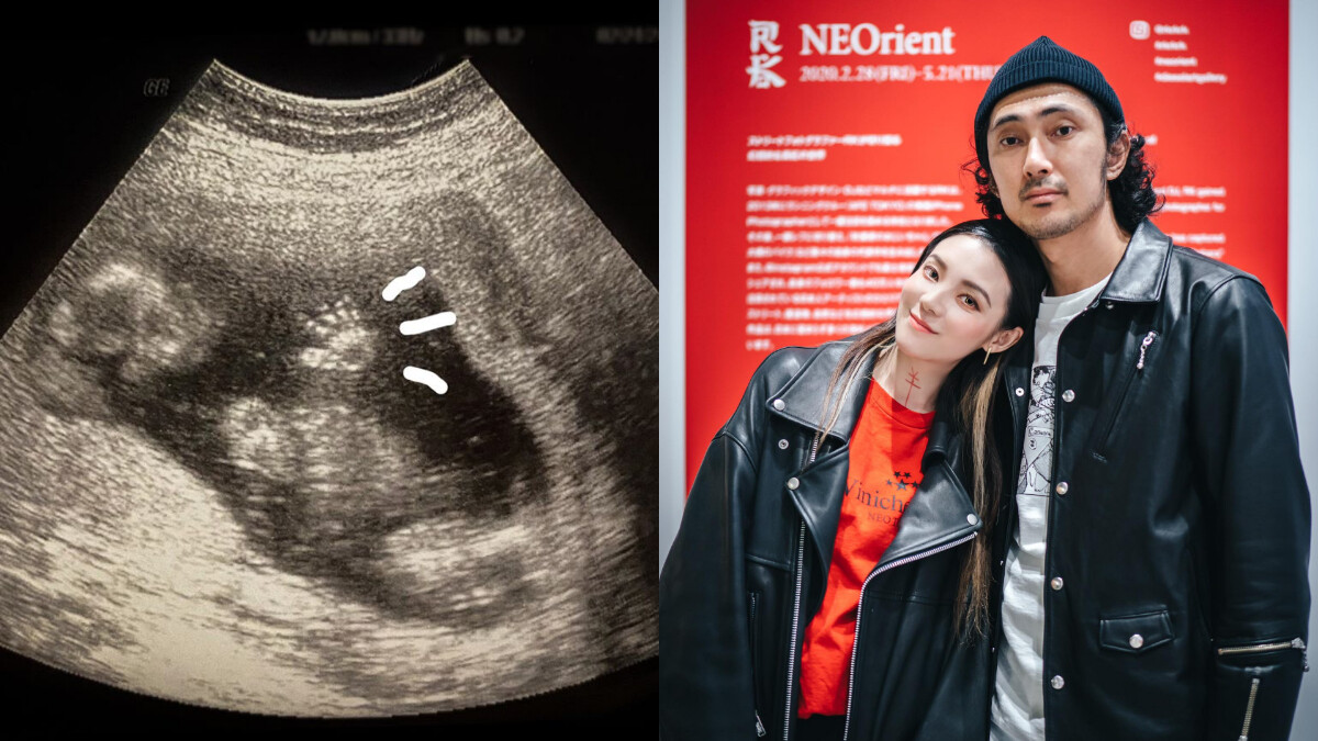 36歲歐陽靖驚喜宣布懷孕5個月！與日本攝影師男友登記結婚，愛情長跑5年修成正果