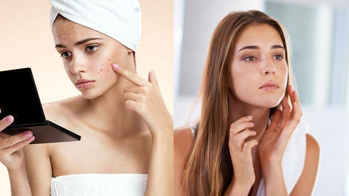 敏弱肌保養對策，避免成為長期發炎肌，讓肌膚變得更敏感的3大NG行為務必小心！