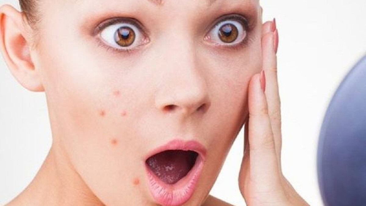 惱人冬季癢、蕁麻疹、青春痘......風寒、虛寒易引發皮膚病，3招養出好膚況！