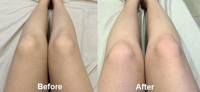 Melano CC使用三週後的差異