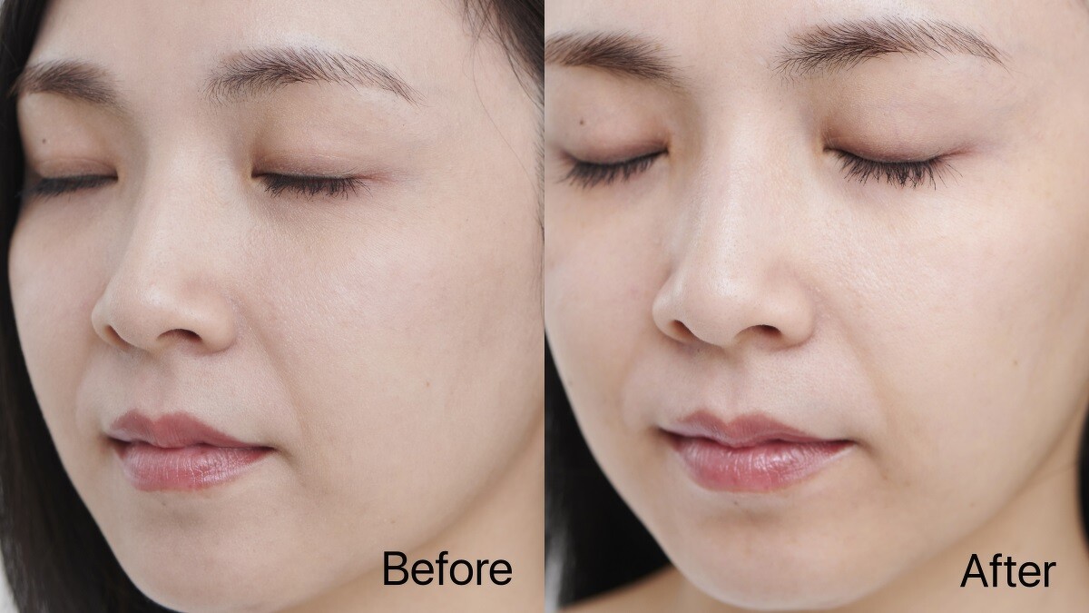 Before:膚色不均、疲態黯沉 / After:白皙透亮，健康光澤