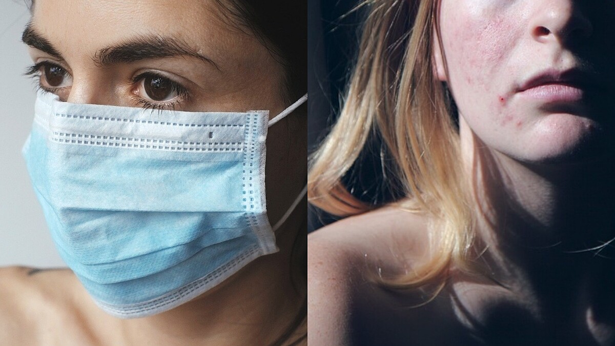 對抗口罩痘痘與粉刺，皮膚科醫師傳授3多3少保養守則，原來「複合酸類煥膚精華液」這麼有用！