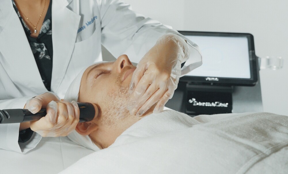 法比歐的肌膚清潔秘密武器就是黑鑽水飛梭