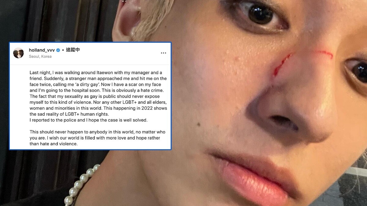 韓國同志歌手Holland自曝被毆打及語言羞辱