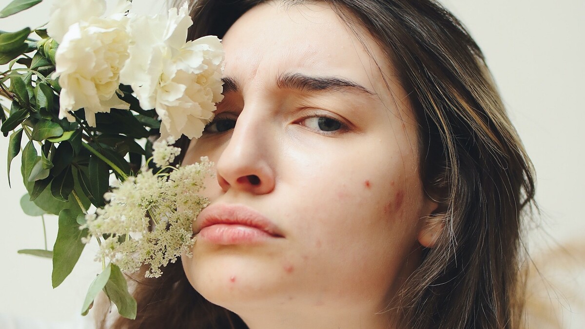 鼻子長痘痘？中醫解析：從臉頰、下巴…這些痘痘位置看出身體狀況，還有改善方法