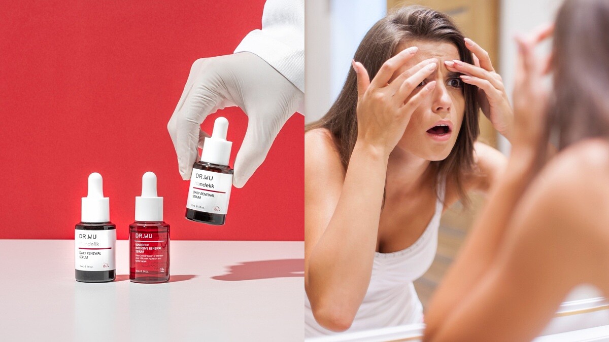 杏仁酸、茶樹精油、褐黴素對痘痘都有效？常見抗痘成份怎麼用？讓皮膚科醫師來解答！