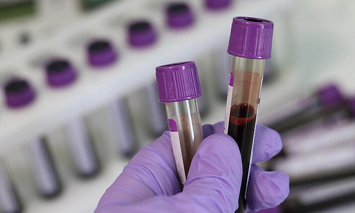 (大部分現在進行的血型研究是為了追溯歷史、尋找人種來源,或者探究為何某些人種特別或較不容易罹患某種疾病。圖片來源 / Pixabay)