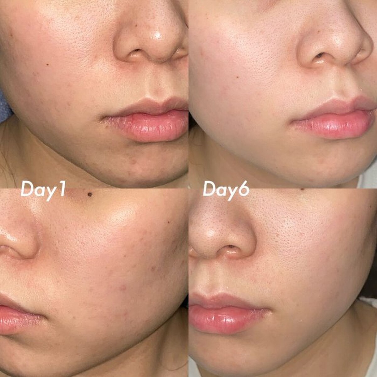 圖片提供Dcard_雞腿小公主