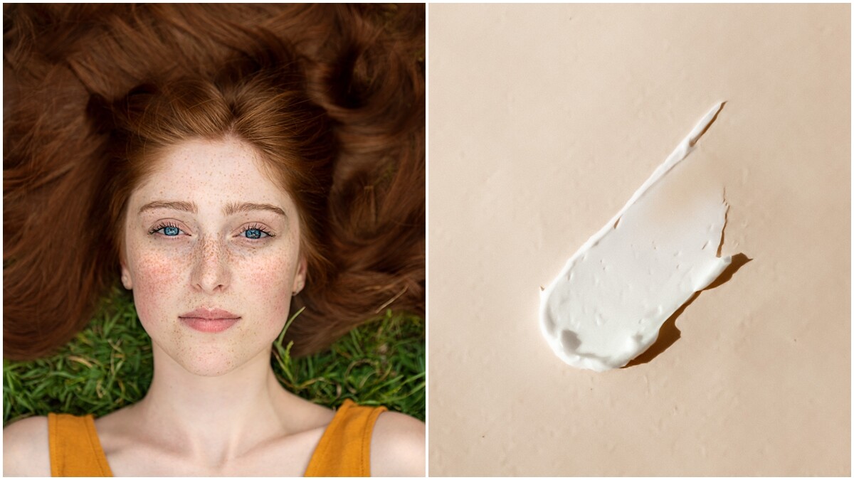 肌膚發紅、長膿皰，我是酒糟肌還是痘痘肌？酒糟該如何保養？