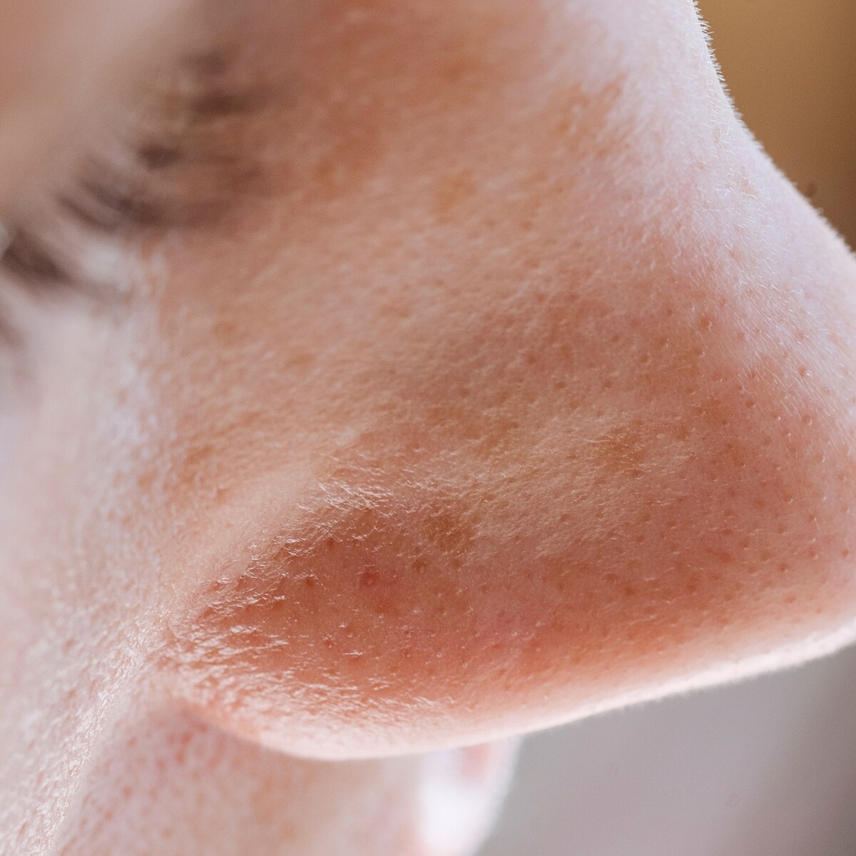 很多人對膚質不滿意的主因都是因為「毛孔粗大」。