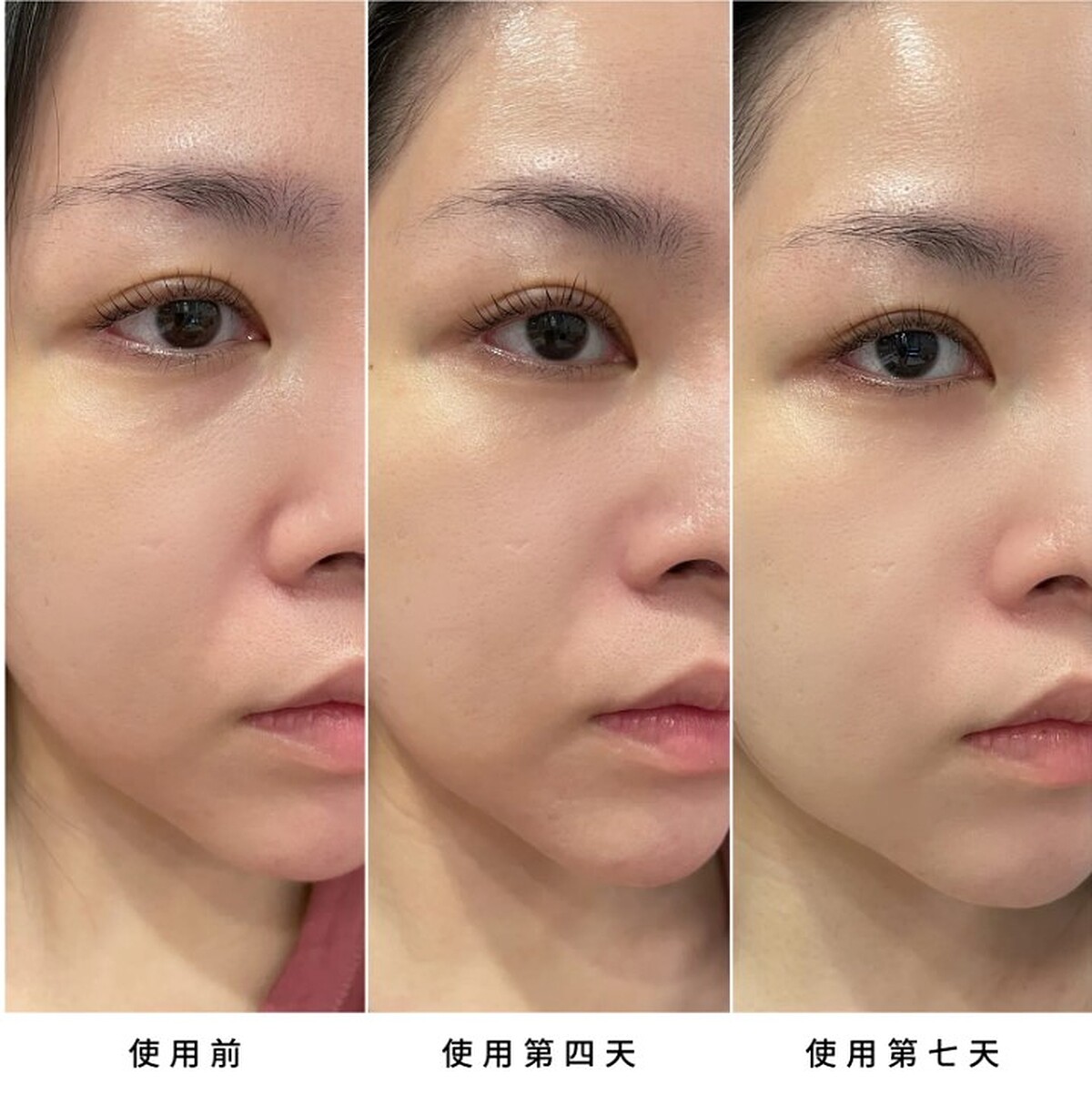 網友曬出BA照，直呼【黑曜岩新生奇蹟高效眼活萃】是紋路剋星