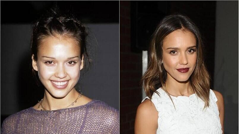 什麼！連她也有整型嗎？ 15個出乎意料有整型的好萊塢大明星是…