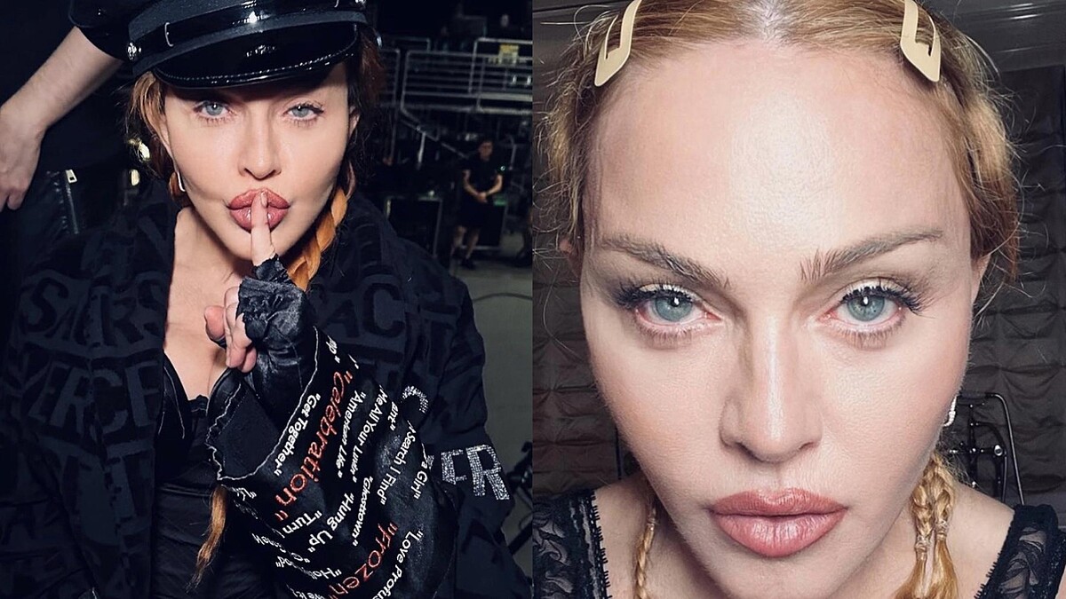 瑪丹娜驚傳失去知覺!出現嚴重細菌感染,緊急送加護病房治療