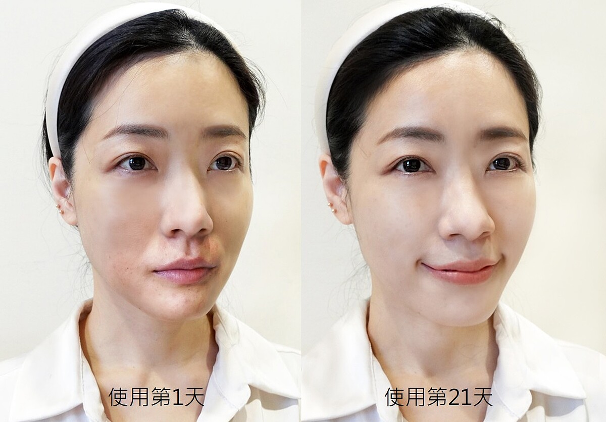 實際使用小紅水前後的差異