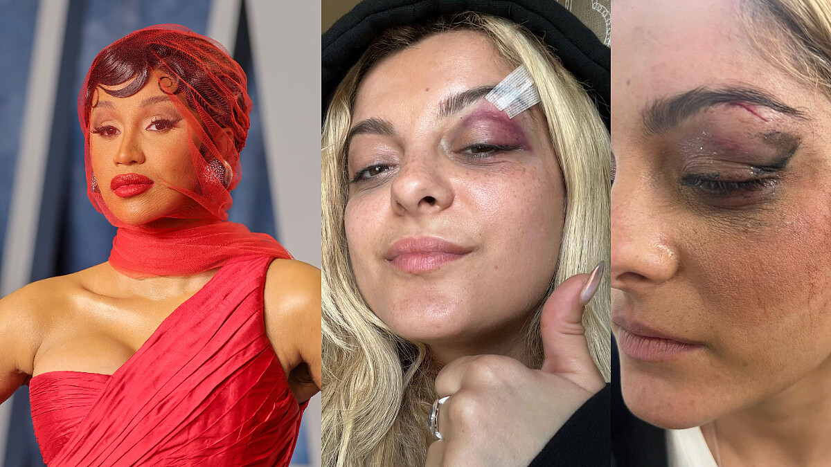 Cardi B怒甩麥克風!演唱中竟遭觀眾潑液體:BLACKPINK、Harry Styles、Bebe Rexha也曾發生過?!