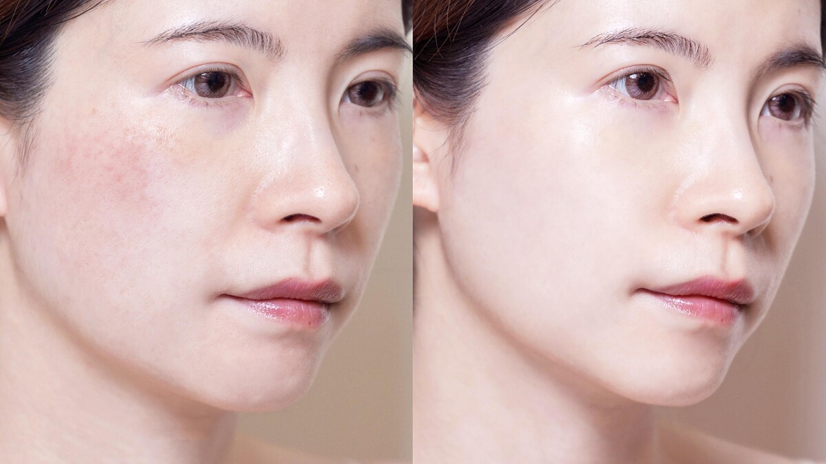 圖片來源：Marie Claire *根據真實個案體驗，使用效果因人而異