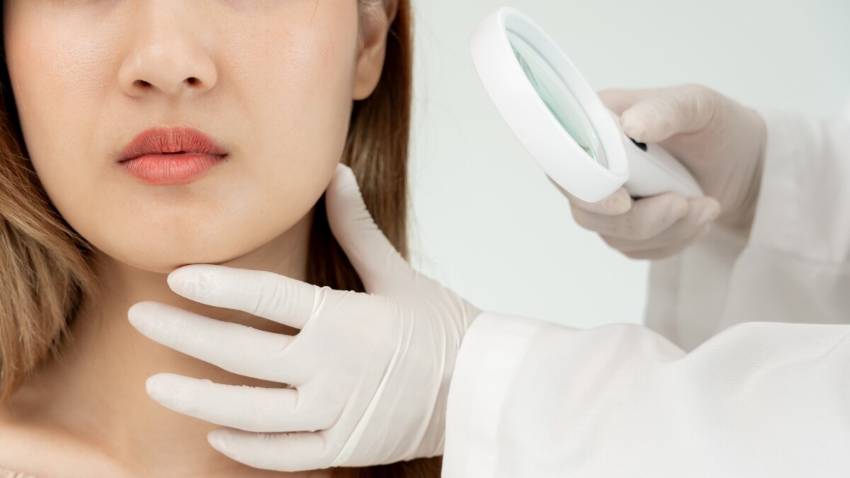 【保養知識王】粉刺是什麼？長了該怎麼辦？處理方法與5個保養重點公開