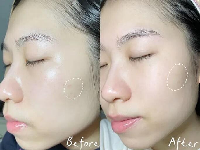 圖片來源：Dcard@Anita