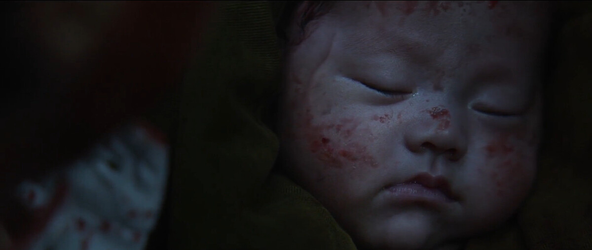 嬰兒右臉皮下浮現納人游入太陽穴