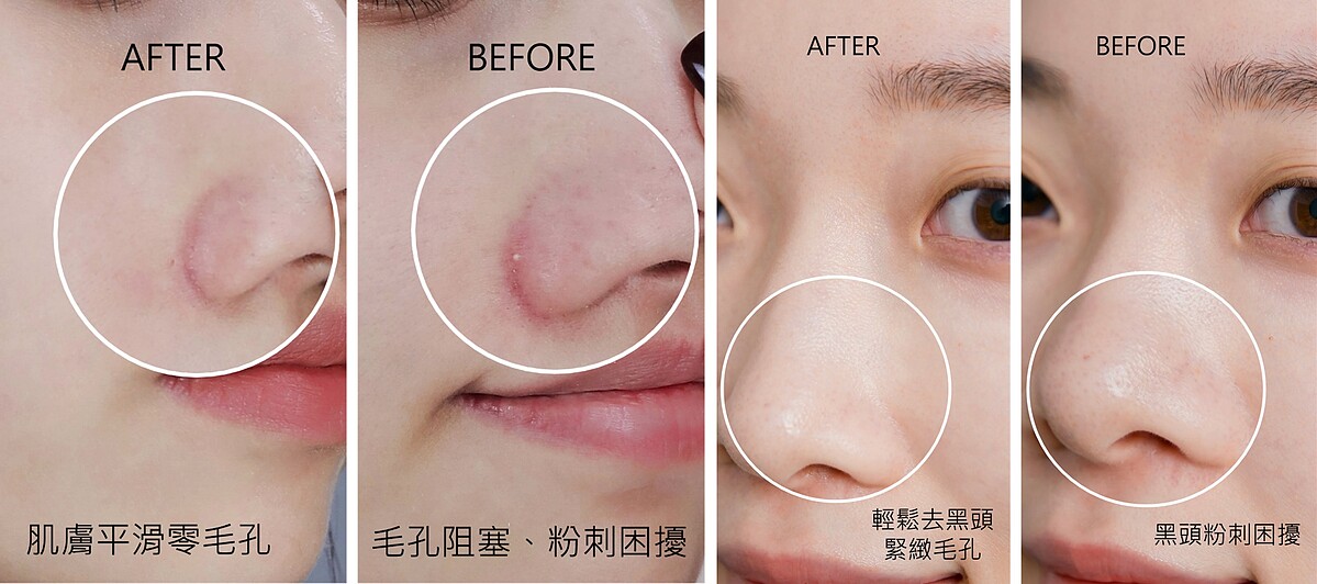 網友實測「黑米精萃潔顏油」卸妝，有效去除黑頭、收縮毛孔，肌膚重現光滑無瑕