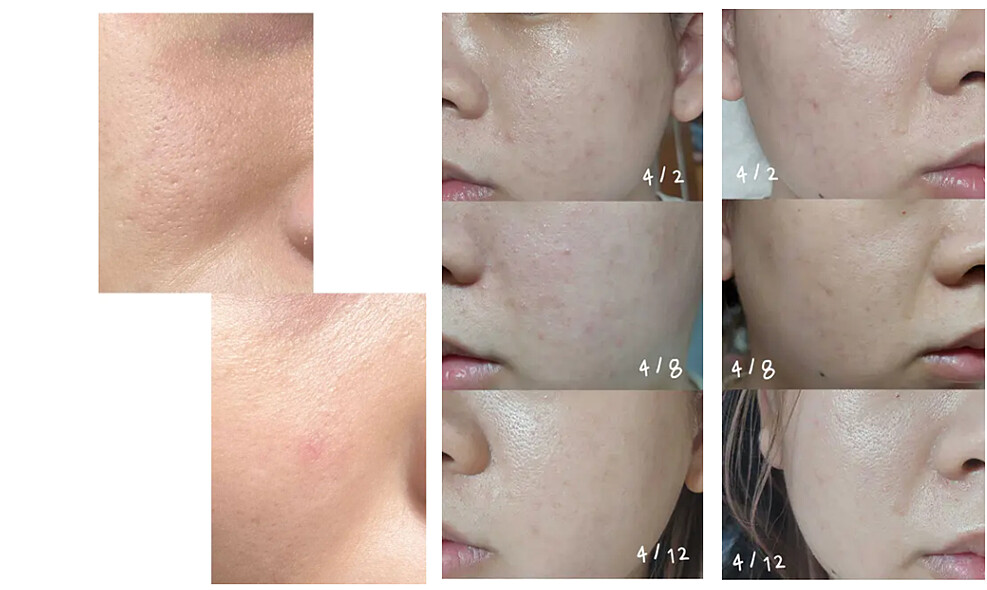 照片來自Dcard體驗箱網友心得