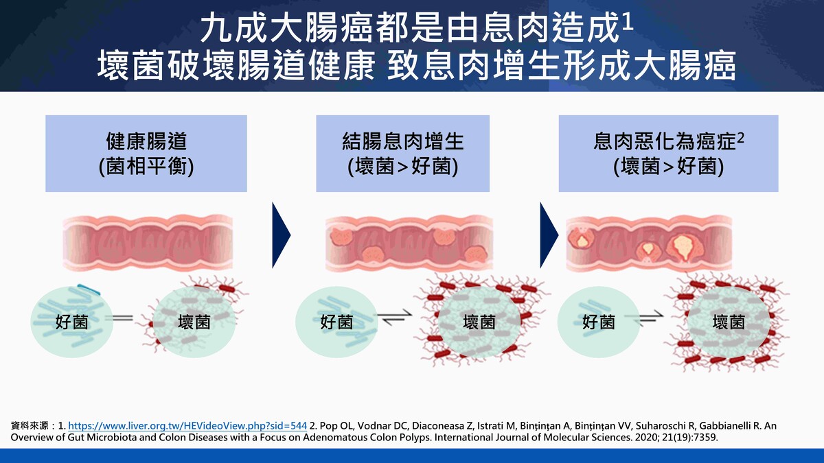 不良習慣致腸道壞菌過多,造成腸道發炎並誘發息肉生長,最終癌化。