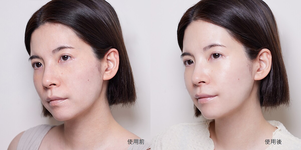 貝膚黛瑪 #藍繃帶保濕精華 一秒開啟水光通道，M編親自用過超有感