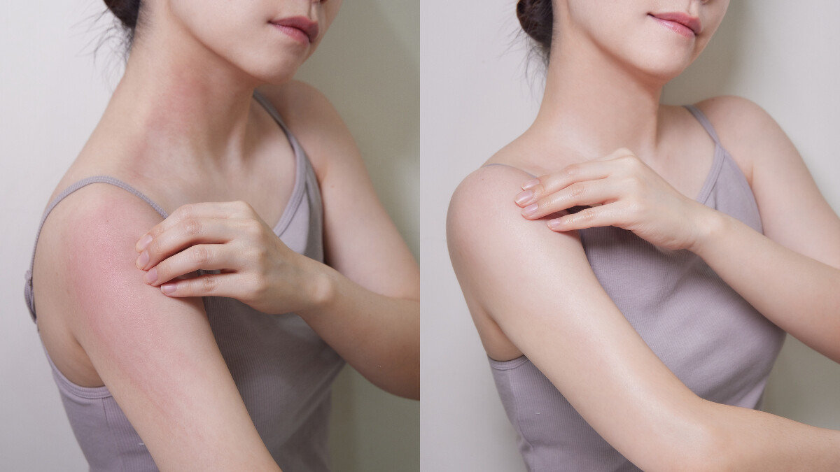 左 : 未使用前乾癢、紅癢、搔抓，右 : 使用後鎮定舒緩