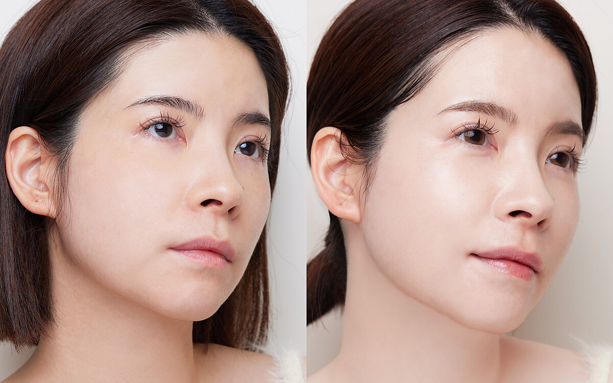 左 : 使用前肌膚暗沉,右 : 使用後肌膚透亮平滑