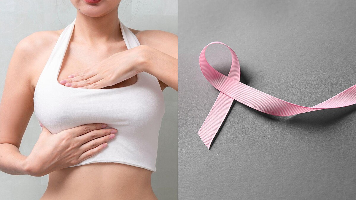 乳頭出血別輕忽！可能是乳頭內長腫瘤，乳癌風險增5倍