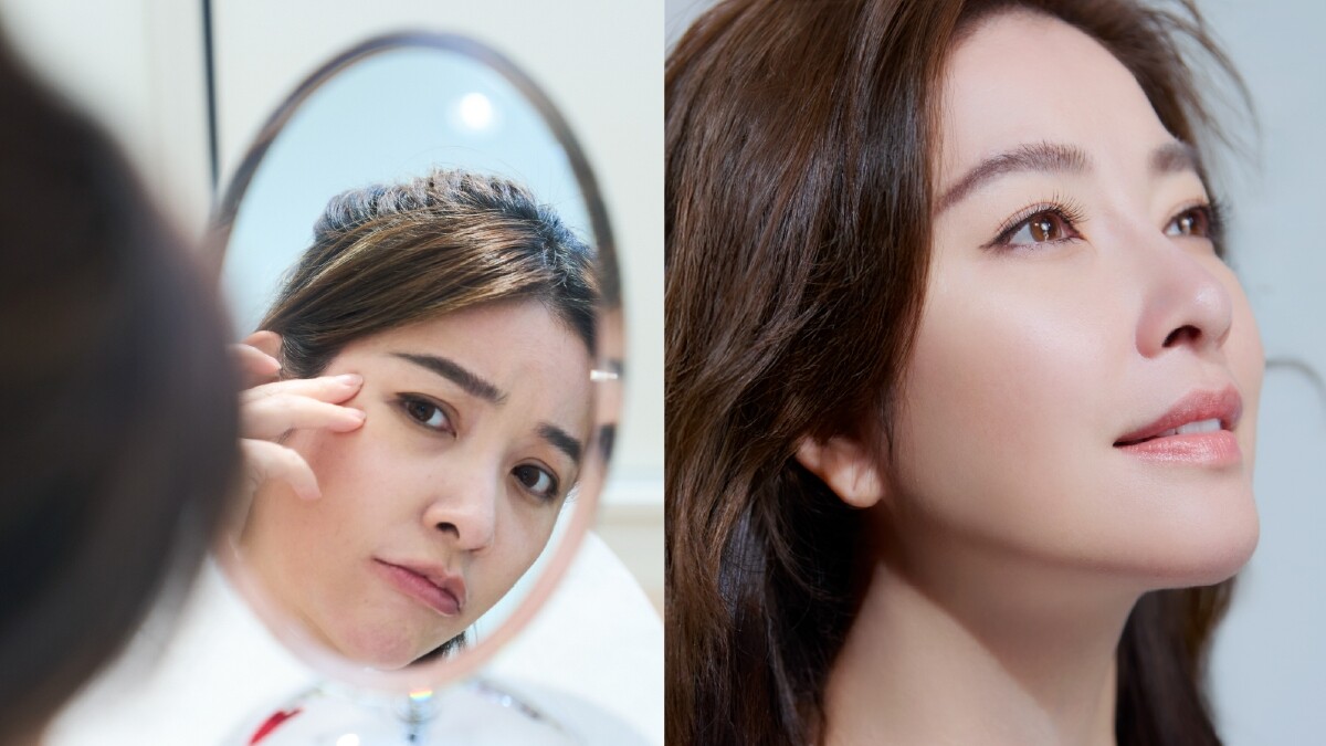 擺脫眼袋、淚溝、黑眼圈！幸福女人許維恩眼底的光…有老公給的愛情、有君綺醫美「無痕三點定位」創造自信電眼！無需動大刀、恢復期短的超強眼袋手術