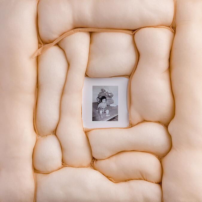 郭玫秀《皮膚上的珊瑚》