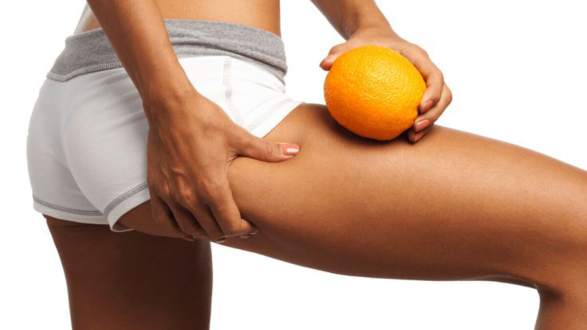 橘皮組織是什麼？筋肉媽媽：唯有「這招」能徹底消除它