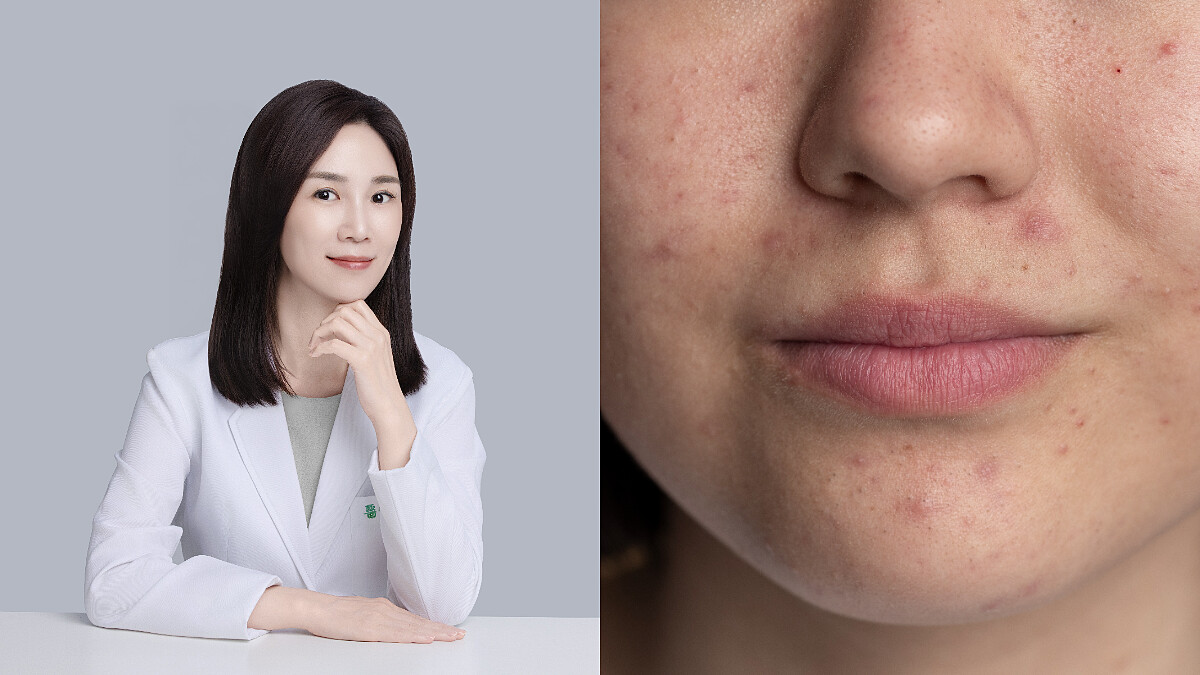 水楊酸、杏仁酸、菸鹼醯胺的功用是什麼?皮膚科醫師完整解析2026抗痘黃金三成分